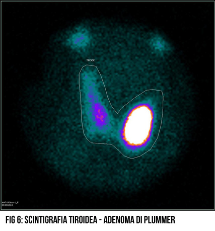 fig6