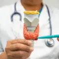 Carcinoma tiroideo: cosa cambia con le nuove linee guida 2025